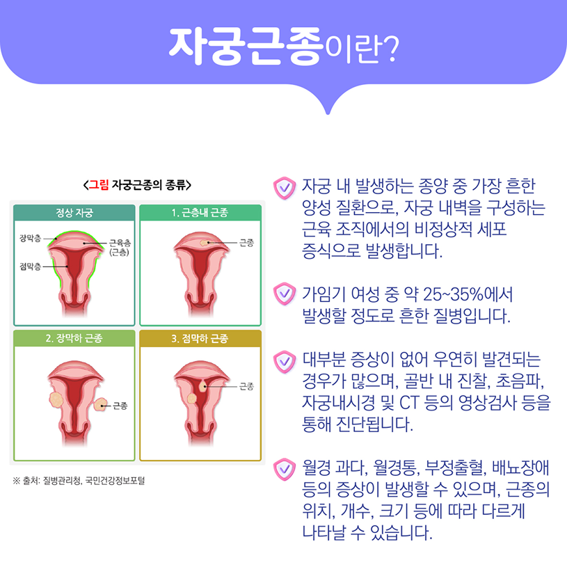 자궁근종이란? 상세내용 하단참조