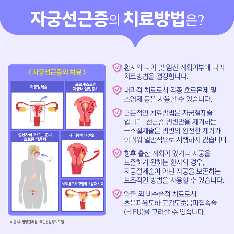 자궁선근증의 치료방법은? 상세내용 하단참조