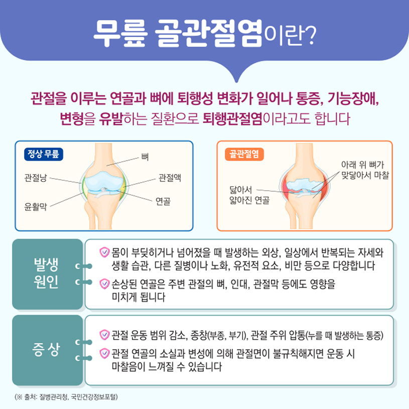 무릎 골관절염이란? 상세내용 하단참조
