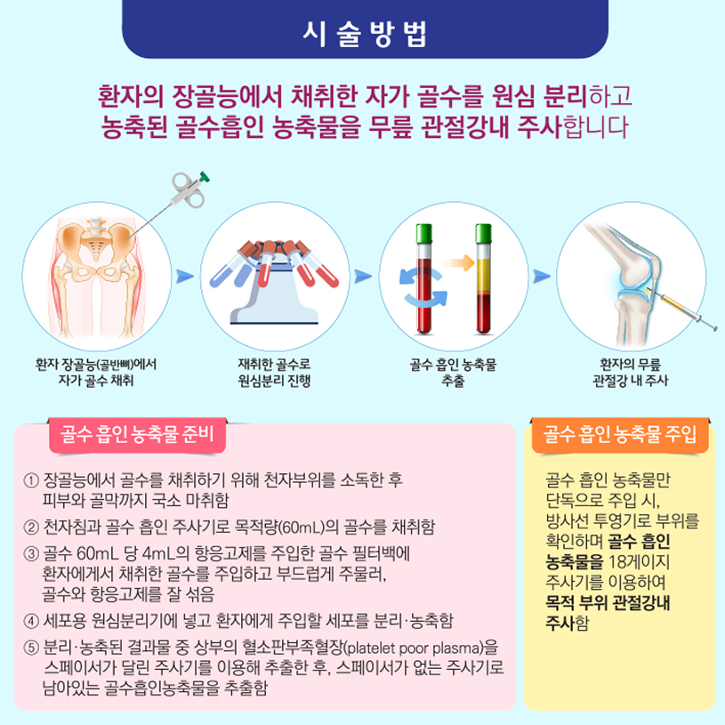 시술방법 상세내용 하단참조