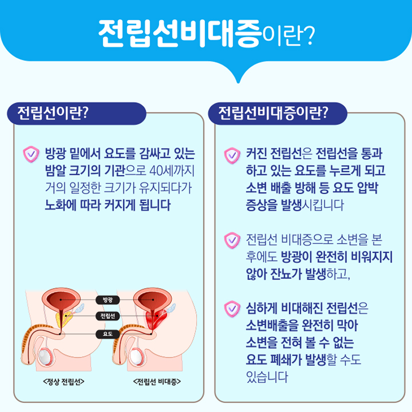전립선비대증이란? 상세내용 하단참조