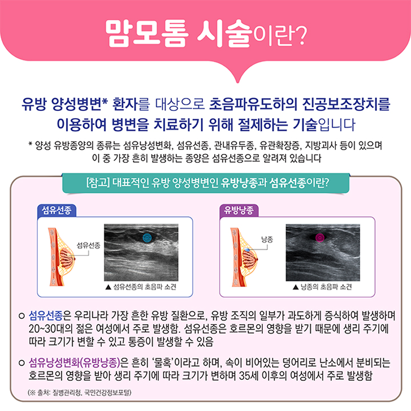맘모톰 시술이란? 상세내용 하단참조