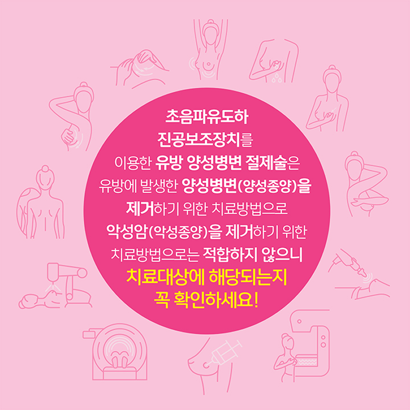 초음파유도하 진공보조장치를 이용한 유방 양성병변 절제술은 유방에 발생한 양성병변(양성종양)을 제거하기 위한 치료방법으로 악성암(악성종양)을 제거하기 위한 치료방법으로는 적합하지 않으니 치료대상에 해당되는지 꼭 확인하세요!