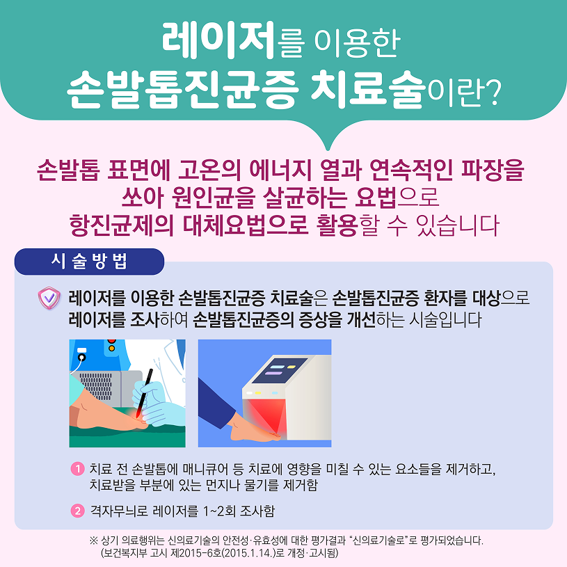 레이저를 이용한 손발톱진균증 치료술이란? 상세내용 하단참조